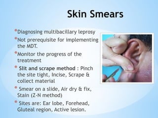 Leprosy and NLEP programme community medicine | PPTX