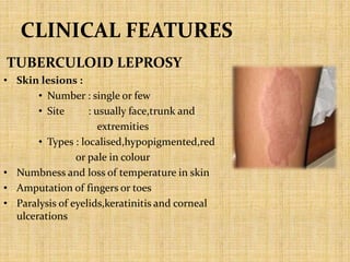 CLINICAL FEATURES
TUBERCULOID LEPROSY
• Skin lesions :
• Number : single or few
• Site : usually face,trunk and
extremities
• Types : localised,hypopigmented,red
or pale in colour
• Numbness and loss of temperature in skin
• Amputation of fingers or toes
• Paralysis of eyelids,keratinitis and corneal
ulcerations
 