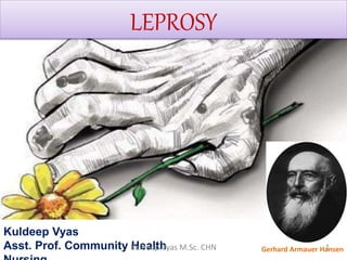 LEPROSY
Kuldeep Vyas
Asst. Prof. Community Health Gerhard Armauer Hansen1Kuldeep Vyas M.Sc. CHN
 