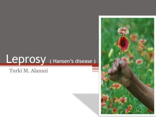 Leprosy ( Hansen’s disease )
Turki M. Alanazi
 