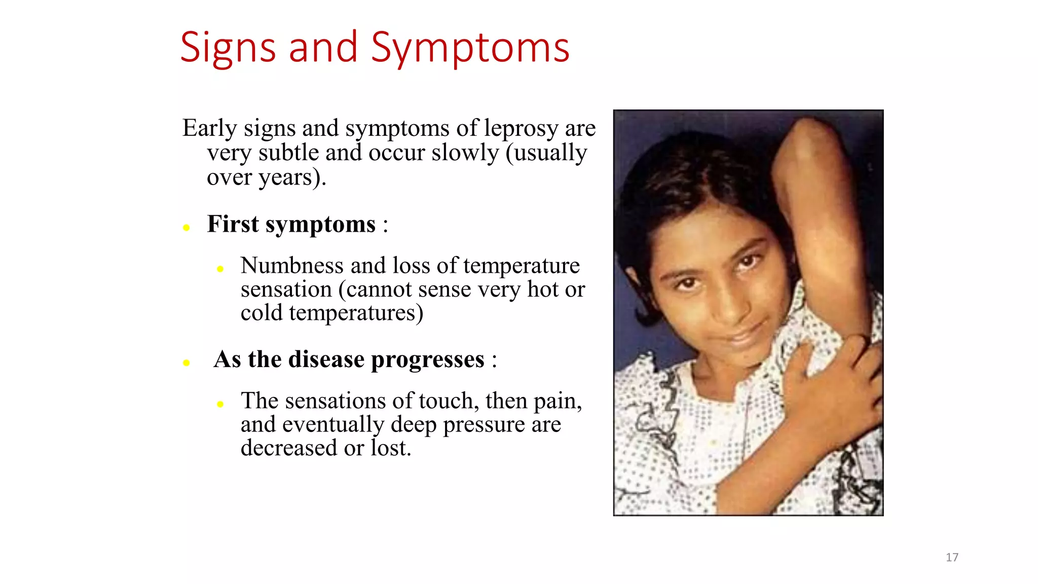 Leprosy (Hansen’s Disease).pptx