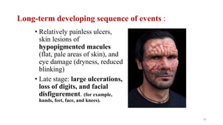 Leprosy (Hansen’s Disease).pptx