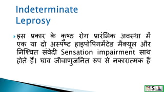  इस प्रकार क
े क
ु ष्ठ रोग प्रारंशभक अवस्था में
एक या दो अस्पष्ट हाइपोवपगमेंटेि मैक्यूल और
ननजश्चत संवेदी Sensation impairment साथ
होते हैं। घाव जीवाणुजननत रूप से नकारात्मक हैं
 