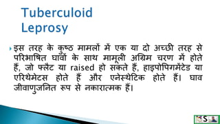  इस तरह क
े क
ु ष्ठ मामलों में एक या दो अच्छ तरह से
पररभावषत घावों क
े साथ मामूली अगिम चरण में होते
हैं, जो फ्लैट या raised हो सकते हैं, हाइपोवपगमेंटेि या
एररथेमेटस होते हैं और एनेस्थेटटक होते हैं। घाव
जीवाणुजननत रूप से नकारात्मक हैं।
 
