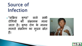 "सक्रक्रय क
ु ष्ठ" वाले सभी
रोगगयों को संक्रामक माना
जाता है। क
ु ष्ठ रोग क
े मानव
मामले संक्रमण का मुख्य स्रोत
हैं।
 
