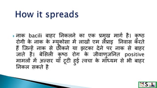  नाक bacili बाहर ननकलने का एक प्रमुख मागग है। क
ु ष्ठ
रोगी क
े नाक क
े म्यूकोसा में लाखों एम लेप्राइ ननवास करते
हैं जजन्हें नाक से छ ंकने या झटका देने पर नाक से बाहर
जाते है। बेशसली क
ु ष्ठ रोग क
े जीवाणुजननत positive
मामलों में अल्सर या टूटी हुई त्वचा क
े माध्यम से भी बाहर
ननकल सकते है
 