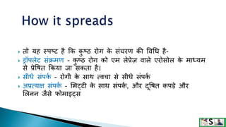  तो यह स्पष्ट है क्रक क
ु ष्ठ रोग क
े संचरण की ववगध है-
 ड्रॉपलेट संक्रमण - क
ु ष्ठ रोग को एम लेप्रेज़ वाले एरोसोल क
े माध्यम
से प्रेवषत क्रकया जा सकता है।
 सीधे संपक
ग - रोगी क
े साथ त्वचा से सीधे संपक
ग
 अप्रत्यक्ष संपक
ग - शमट्टी क
े साथ संपक
ग , और दूवषत कपडे और
शलनन जैसे फोमाइट्स
 