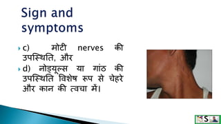  c) मोटी nerves की
उपजस्थनत, और
 d) नोड्यूल्स या गांठ की
उपजस्थनत वविेष रूप से चेहरे
और कान की त्वचा में।
 