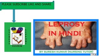 Leprosy in hindi leprosy | PPT