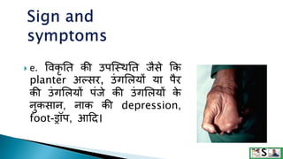 Leprosy in hindi | PPTX