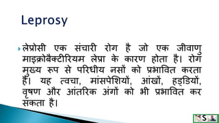 Leprosy in hindi | PPTX