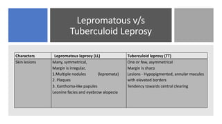 Lepromatous v/s
Tuberculoid Leprosy
Characters Lepromatous leprosy (LL) Tuberculoid leprosy (TT)
Skin lesions Many, symmetrical,
Margin is irregular,
1.Multiple nodules (lepromata)
2. Plaques
3. Xanthoma-like papules
Leonine facies and eyebrow alopecia
One or few, asymmetrical
Margin is sharp
Lesions - Hypopigmented, annular macules
with elevated borders
Tendency towards central clearing
 