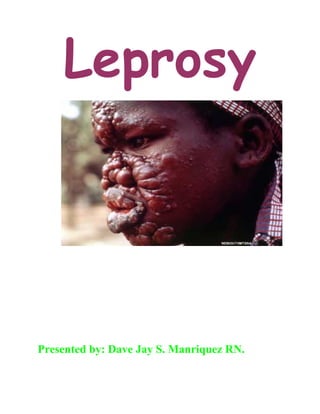 Leprosy
Presented by: Dave Jay S. Manriquez RN.
 
