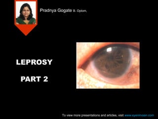 Pradnya Gogate B. Optom,

LEPROSY
PART 2

To view more presentations and articles, visit www.eyenirvaan.com

 