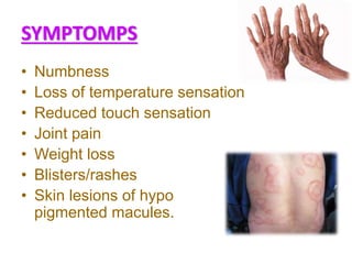 SYMPTOMPS
• Numbness
• Loss of temperature sensation
• Reduced touch sensation
• Joint pain
• Weight loss
• Blisters/rashes
• Skin lesions of hypo
pigmented macules.
 