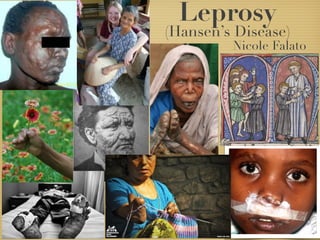 Leprosy project