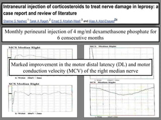 Management of leprosy neuropathy | PPTX