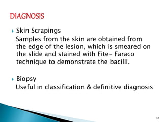  Skin Scrapings
Samples from the skin are obtained from
the edge of the lesion, which is smeared on
the slide and stained with Fite- Faraco
technique to demonstrate the bacilli.
 Biopsy
Useful in classification & definitive diagnosis
32
 