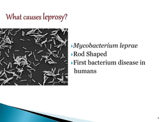 Mycobacterium leprae
Rod Shaped
First bacterium disease in
humans
4
 