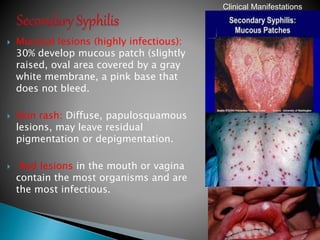  Mucosal lesions (highly infectious):
30% develop mucous patch (slightly
raised, oval area covered by a gray
white membrane, a pink base that
does not bleed.
 Skin rash: Diffuse, papulosquamous
lesions, may leave residual
pigmentation or depigmentation.
 Red lesions in the mouth or vagina
contain the most organisms and are
the most infectious.
42
Clinical Manifestations
 