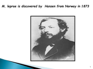 M. leprae is discovered by Hansen from Norway in 1873
5
 