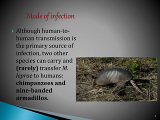  Although human-to-
human transmission is
the primary source of
infection, two other
species can carry and
(rarely) transfer M.
leprae to humans:
chimpanzees and
nine-banded
armadillos.
7
 