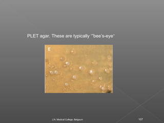 PLET agar. These are typically ‘”bee’s-eye” 
J.N. Medical College, Belgaum 107 
 
