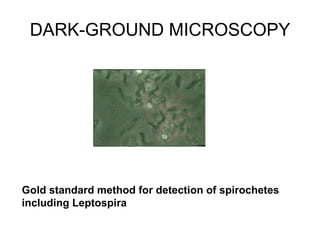 DARK-GROUND MICROSCOPY Gold standard method for detection of spirochetes including Leptospira  