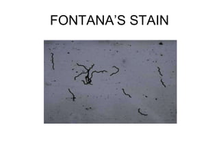 FONTANA’S STAIN 