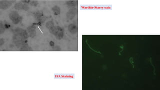 Warthin-Starry stain
IFA Staining
 