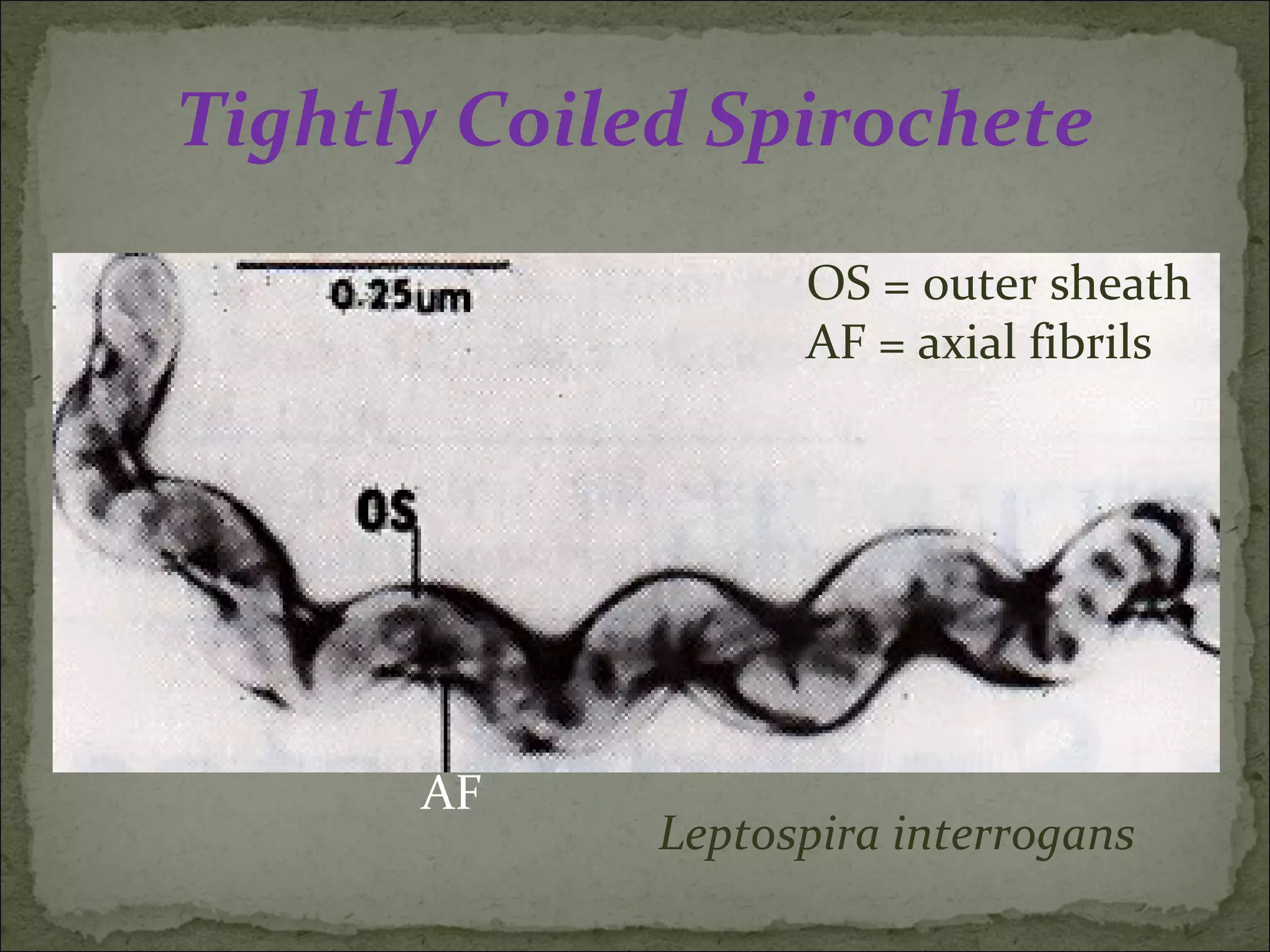 Tightly Coiled Spirochete
                   OS = outer sheath
                   AF = axial fibrils




      AF
             Leptospira interrogans
 