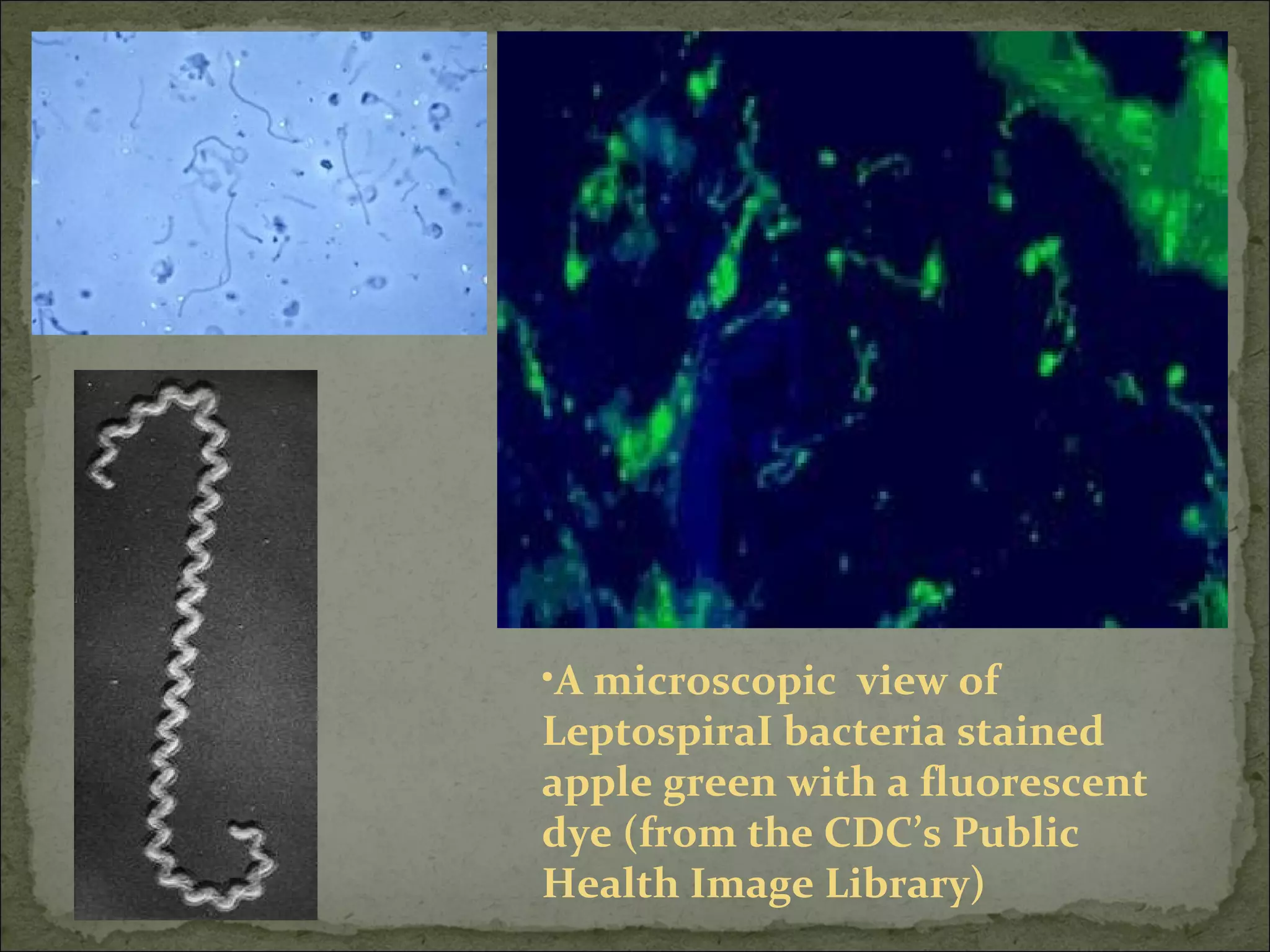 •A microscopic view of
LeptospiraI bacteria stained
apple green with a fluorescent
dye (from the CDC’s Public
Health Image Library)
 