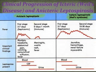 Clinical Progression of Icteric (Weil’s
Disease) and Anicteric Leptospirosis




                (pigmented
                part of eye)
 