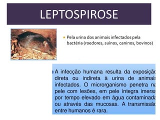 LEPTOSPIROSE

 