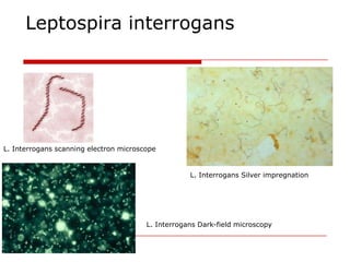 Leptospira interrogans




L. Interrogans scanning electron microscope


                                                    L. Interrogans Silver impregnation




                                        L. Interrogans Dark-field microscopy
 