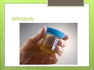 Urinalysis
 