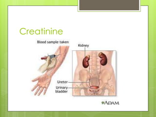 Creatinine
 
