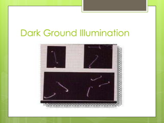 Dark Ground Illumination
 