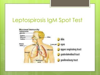Leptospirosis IgM Spot Test
 