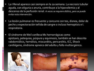  La I Renal aparece casi siempre en la 2a semana. La necrosis tubular

aguda, con oliguria o anuria, contribuye a la hipovolemia y al
descenso de la perfusión renal. A veces se requiere diálisis, pero se puede
evitar esta intervención.

 La lesión pulmonar es frecuente y concurre con tos, disnea, dolor de

pecho y expectoración teñida de sangre o incluso hemoptisis e I.
respiratoria.
 El síndrome de Weil conlleva Mx hemorrágicas como

epistaxis, petequias, púrpura y equimosis, también se han descrito
rabdomiólisis, hemólisis, miocarditis, pericarditis, ICC, Shock
cardiógeno, síndrome apneico del adulto y fallo multiorgánico.

 