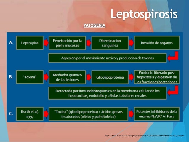 Resultado de imagen de leptospirosis