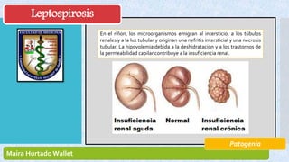 Leptospirosis | PPTX
