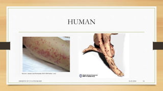 HUMAN
24-09-2020ABHIJITH SP CVAS POOKODE 18
 