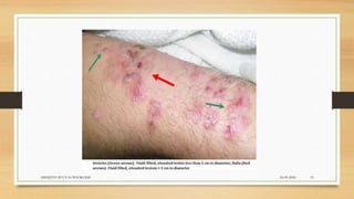 24-09-2020ABHIJITH SP CVAS POOKODE 19
 