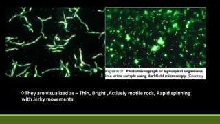 They are visualized as – Thin, Bright ,Actively motile rods, Rapid spinning
with Jerky movements
 