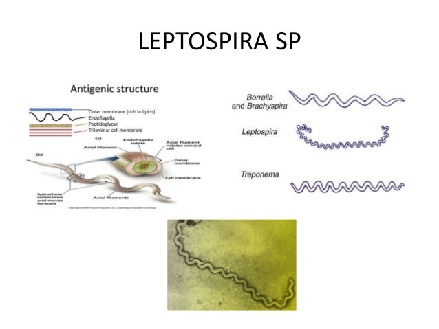 Leptospirosis (1)