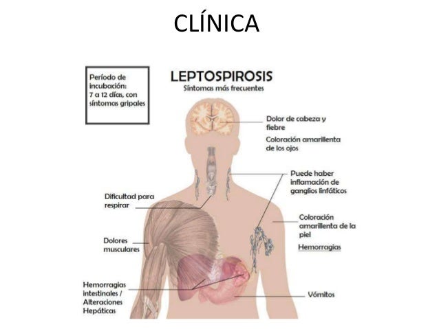 Leptospirosis (1)