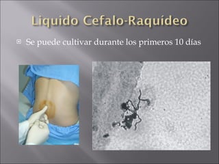 Se puede cultivar durante los primeros 10 días 