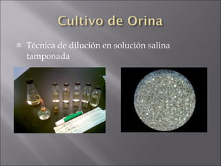 Técnica de dilución en solución salina tamponada 