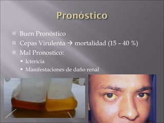 Buen Pronóstico Cepas Virulenta    mortalidad (15 – 40 %) Mal Pronostico: Ictericia Manifestaciones de daño renal 